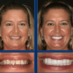 Austin Cosmetic Dentistry Can Get You Ready for That Special Event