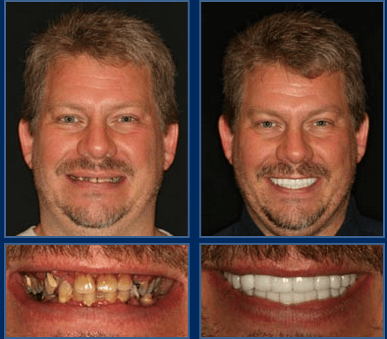 Austin Cosmetic Dentistry At It's Best -The Value of a Beautiful Smile