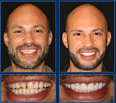 Let An Austin Cosmetic Dentist Transform Your New Year with a Smile Makeover!