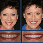 An Austin Cosmetic Dentist Can Create Life Changing Smiles!