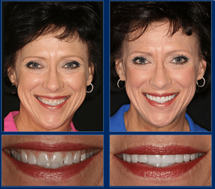An Austin Cosmetic Dentist Can Create Life Changing Smiles!