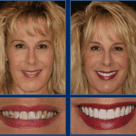 An Austin Cosmetic Dentist Can Get You Ready For Spring With a Smile Makeover! Call today to schedule a Complimentary Consultation at 512.333.7777.