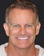 Austin Cosmetic Dentistry | Kevin