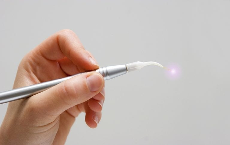 Close-up of a dentist's hand holding a dental laser tool at The Cosmetic Dentists of Austin.