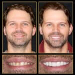 Best Reconstructive Dentist in Austin. Call 512.333.7777 for A Free Consult