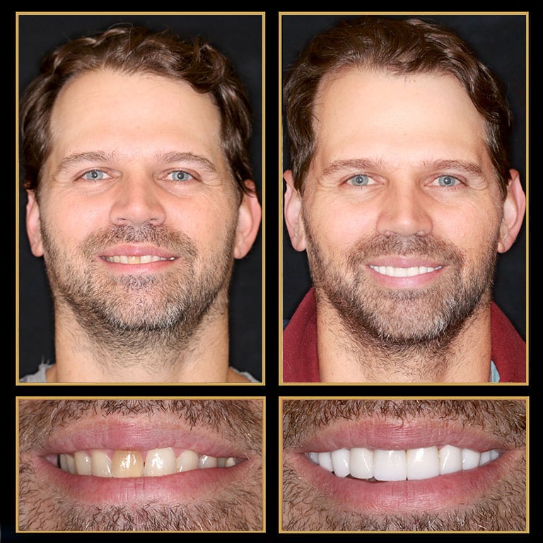 Best Reconstructive Dentist in Austin. Call 512.333.7777 for A Free Consult