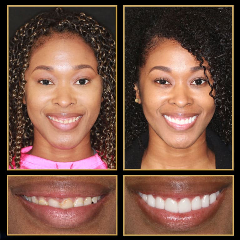 The Cosmetic Dentists of Austin Offers Easy Financing Options To make Your Cosmetic Treatment Affordable